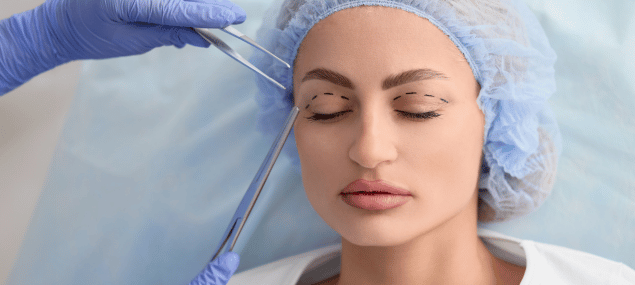 Blefaroplastia-avant-cirurgias-faciais